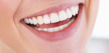 Cosmetic Dentistry